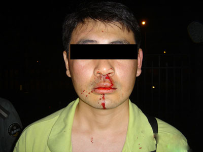 国风北京业主夜间在小区内被不明身份者打伤 